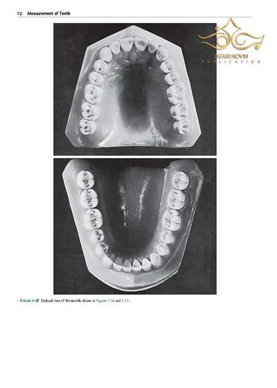 Wheeler's Dental Anatomy, Physiology and Occlusion فیزیولوژی و آناتومی ویلر