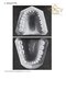 Wheeler's Dental Anatomy, Physiology and Occlusion فیزیولوژی و آناتومی ویلر