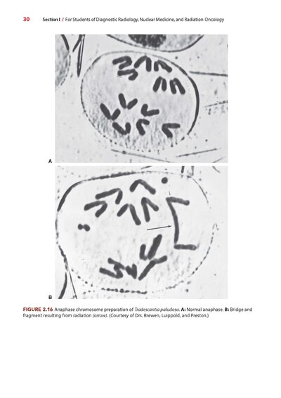 Radiobiology for the Radiologist