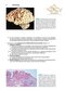 BRS Pathology (Board Review Series) Fifth, North American Edition