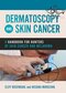 دانلود کتاب Dermatoscopy and Skin Cancer : A handbook for hunters of skin cancer ... 