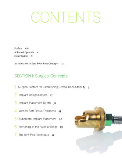 Zero Bone Loss Concepts 1st Edition 2019
