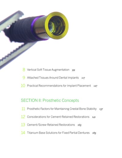 Zero Bone Loss Concepts 1st Edition 2019