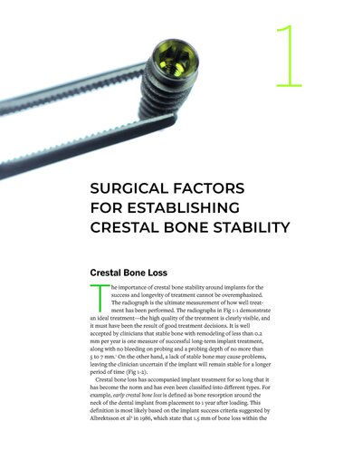 Zero Bone Loss Concepts 1st Edition 2019