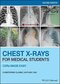 دانلود کتاب Chest X-Rays for Medical Students: CXRs Made Easy 2nd Edition2020