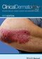 دانلود کتاب Clinical Dermatology, 5th Edition 2015