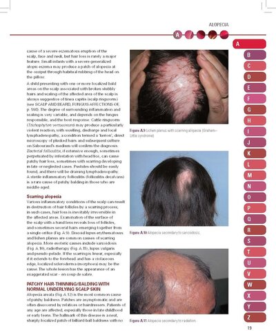 French’s Index of Differential Diagnosis An A-Z 1 16th Edition 2016