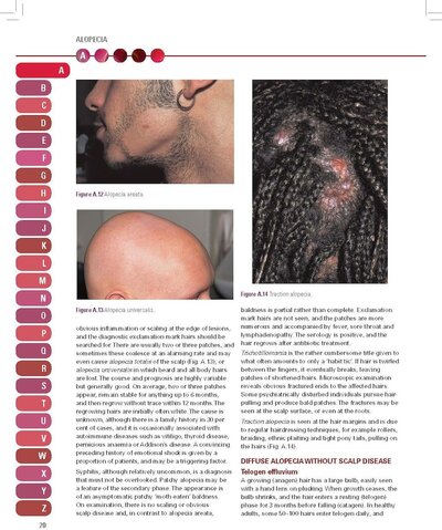 French’s Index of Differential Diagnosis An A-Z 1 16th Edition 2016