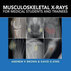 دانلود کتاب Musculoskeletal X-Rays for Medical Students and Trainees