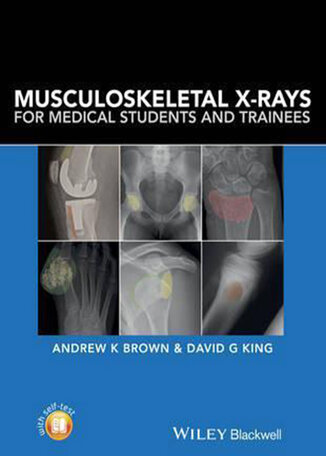 عکس دانلود کتاب Musculoskeletal X-Rays for Medical Students and Trainees