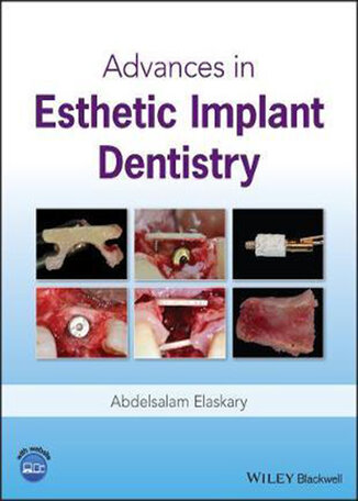 عکس دانلود کتاب Advances in Esthetic Implant Dentistry2019