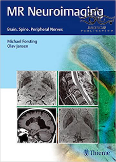 عکس دانلود کتاب MR Neuroimaging: Brain, Spine, and Peripheral Nerves 1st Edition207  ... 