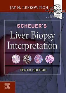عکس دانلود کتاب Scheuer’s Liver Biopsy Interpretation 10th Edition 2020