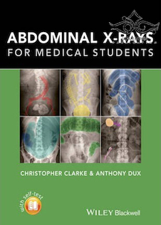 عکس دانلود کتاب Abdominal X-rays for Medical Student2015