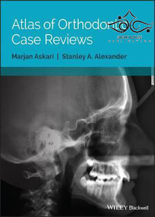 تخفیف دانلود کتاب Atlas of Orthodontic Case Reviews, 1st Edition2017
