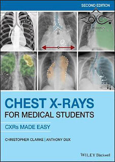 تخفیف دانلود کتاب Chest X-Rays for Medical Students: CXRs Made Easy 2nd Edition2020