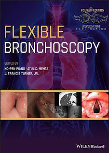 تخفیف دانلود کتاب Flexible Bronchoscopy, 4th Edition2020 برونکوسکوپی انعطاف پذیر