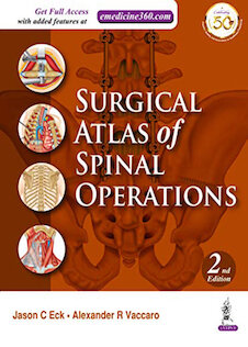 تخفیف دانلود کتاب Surgical Atlas of Spinal Operations, 2nd Edition
