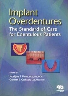 تخفیف دانلود کتاب Implant Overdentures as the Standard of Care for Edentulous Patients