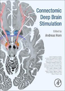 تخفیف دانلود کتاب Connectomic Deep Brain Stimulation