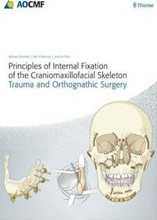 تخفیف دانلود کتاب Principles of Internal Fixation of the Craniomaxillofacial Skeleton  ... 