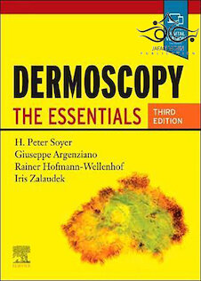 تخفیف دانلود کتاب Dermoscopy: The Essentials, 3rd Edition