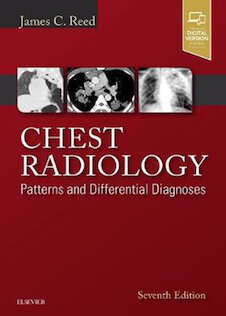 تخفیف دانلود کتاب Chest Radiology : Patterns and Differential Diagnoses