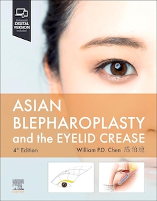 دانلود کتاب Asian Blepharoplasty and the Eyelid Crease  4th Edition