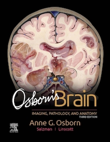 دانلود کتاب Osborn's Brain 3rd Edition