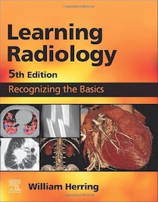 دانلود کتاب Learning Radiology Recognizing the Basics 5th Edition 2024