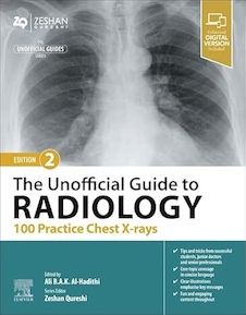 دانلود کتاب The Unofficial Guide to Radiology: 100 Practice Chest X-rays 2nd Edition