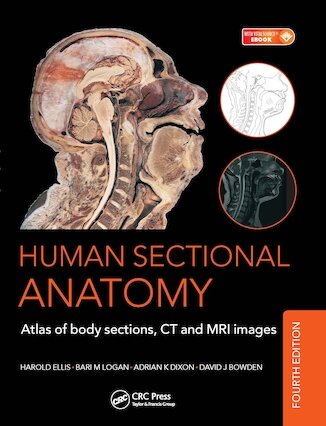 تخفیف دانلود کتاب Human Sectional Anatomy: Atlas of Body Sections, CT and MRI Images,  ... 