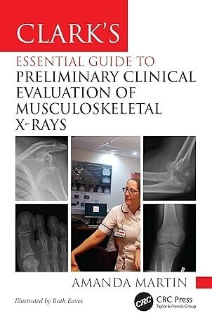 تخفیف دانلود کتاب Clark’s Essential Guide to Preliminary Clinical Evaluation of Muscul ... 