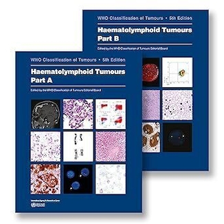عکس دانلود کتاب Haematolymphoid Tumours: WHO Classification of Tumours 5th Edition